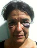 La activista Carmen Roger, agredida por la Polica | EFE